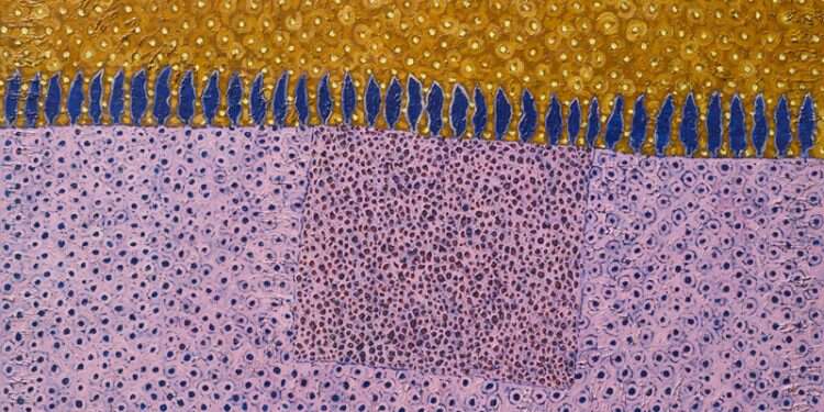 השמרנות עלולה לסנדל את היהודית