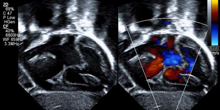 זיהוי מום באולטרסאונד (אילוסטרציה). צילום: שאטרסטוק חוקרים ישראלים זיהו גן הגורם מומי לב קשים בילדים