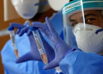 קיצור בידוד: למה חולי הקורונה משוחררים בלי בדיקה?