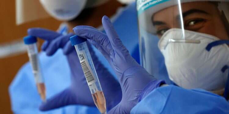 דגימות שנלקחו לגילוי קורונה. צילום: AFP קיצור בידוד: למה חולי הקורונה משוחררים בלי בדיקה?