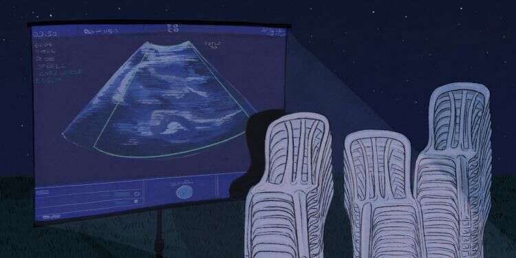 לידה שקטה היא חלק מהחיים, וזו לא אשמתכם