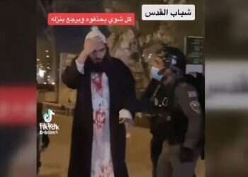 תוקפים חרדים ומתעדים בטיקטוק: האלימות הערבית עולה שלב