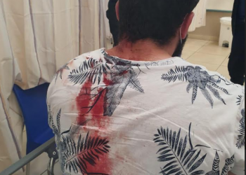 לפני פרוץ המהומות: משפחה יהודית עברה לינץ' בכפר ערבי בגליל