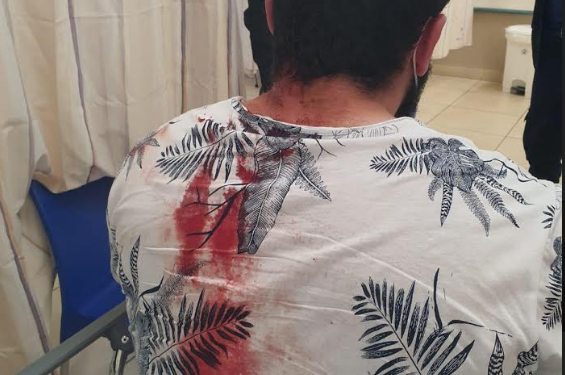 אחד מבני המשפחה בבית החולים. צילום: איילת דיין לפני פרוץ המהומות: משפחה יהודית עברה לינץ' בכפר ערבי בגליל