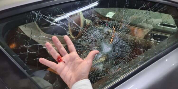 היד הפצועה של הנהג ושמשת החלון המנופצת ברכב של הרב שמואל אליהו רכבו של הרב שמואל אליהו נרגם באבנים