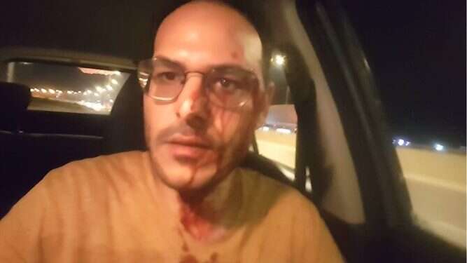 כתבי אישום הוגשו נגד שישה ממבצעי הלינץ' בכביש 60