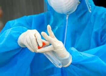 חולה קורונה בן 12 נמצא נושא את הווריאנט "דלתא פלוס"