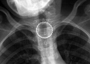 אם לא למגר את הקורונה, אז לפחות את הפקק שלה