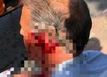 נוסע דקר ופצע נהג אוטובוס בצפת