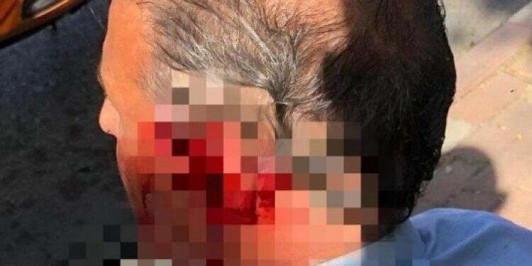 נוסע דקר ופצע נהג אוטובוס בצפת