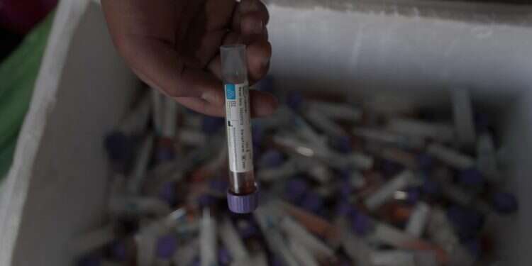 בדיקות קורונה בישראל. צילום: EPA משרד הבריאות: 744 נדבקים בקורונה ביממה האחרונה