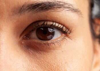 איך מתבצע ניתוח עפעפיים?