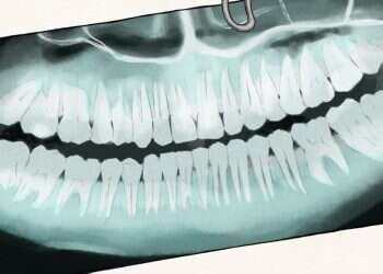 איור: שרון ארדיטי