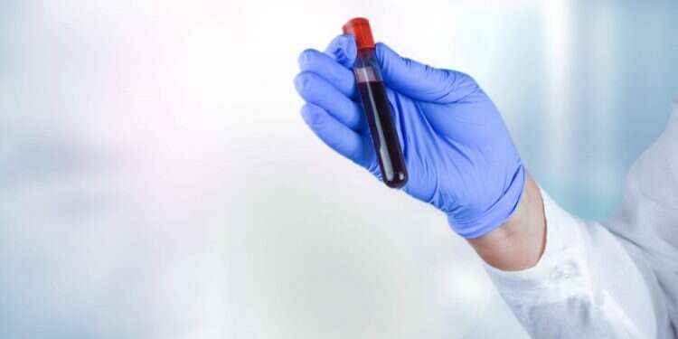 מדענים מתקרבים לפיתוח תחליף מלאכותי לדם