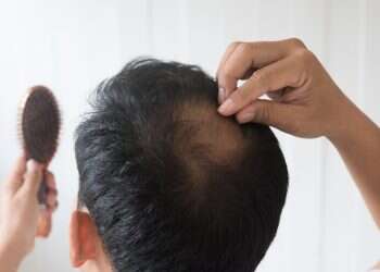 איך להחזיר את השיער כאשר השיער נשר