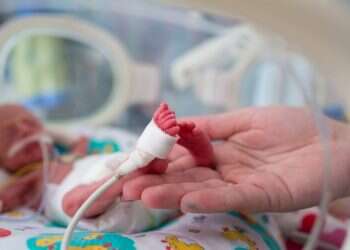 פג פגייה תינוק לידה בית חולים