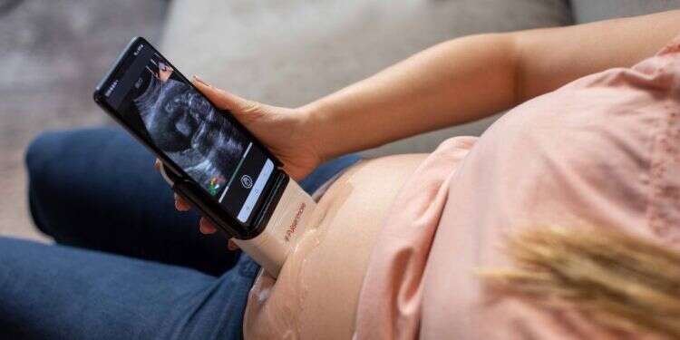 אולטרסאונד מבלי לצאת מהבית: מכשיר חדש ישפר לך את תקופת ההריון