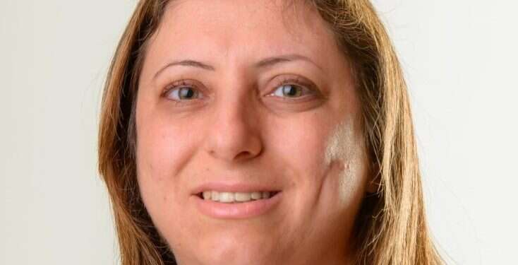 ד "פורצת דרך בתחומה": חתאם חוסיין תשיא משואה, ומאמינה שאנחנו חזקים מהכל