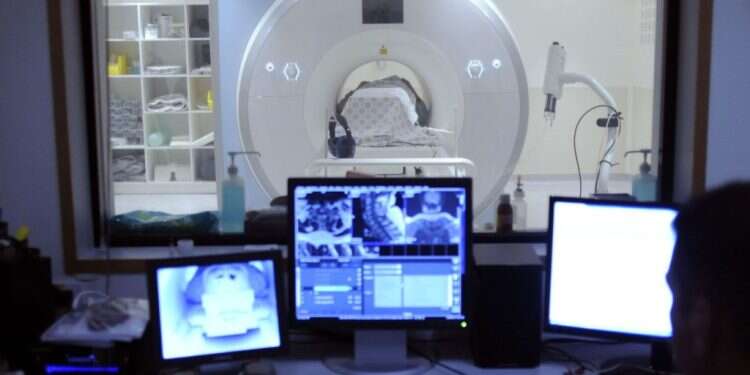 מדענים הצליחו "לפענח מחשבות" על ידי חיבור של MRI ו-chatGPT