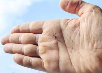 יש מיליון סיבות שאלמנות לא ישנות בלילה – זו המעצבנת מכולן