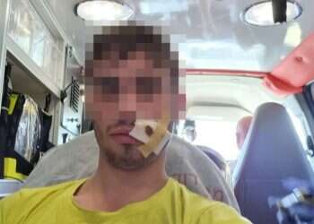 בחור הישיבה שהותקף. צילום: חוננו תופעה חוזרת באתרי הקיאקים: בחורי ישיבות מוכים בידי ערבים