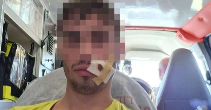 בחור הישיבה שהותקף. צילום: חוננו תופעה חוזרת באתרי הקיאקים: בחורי ישיבות מוכים בידי ערבים