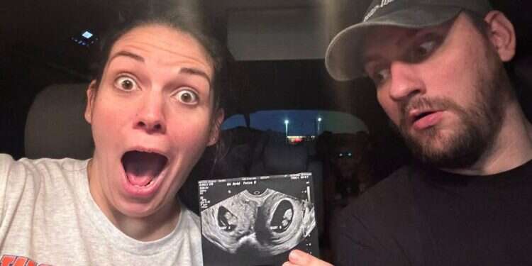 קלסי הצ'ר ובעלה מציגים את האולטרסאונד שבו נראות התאומות בשני הרחמים שלה. צילום: AFP קלסי הצ'ר ובעלה מציגים את האולטרסאונד שבו נראות התאומות בשני הרחמים שלה