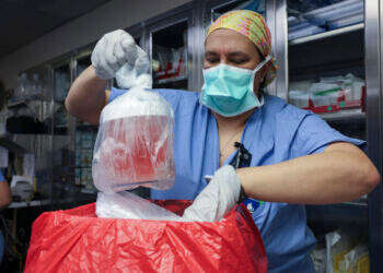 כליית החזיר לפני שהושתלה במטופל