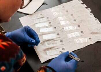 אשרי עין ראתה: הטיפול החדש שירפא עיוורים