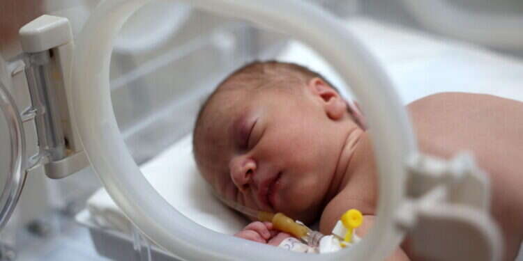 התינוק, מאלק יאסין. צילום: AFP רופאים בעזה: יילדנו תינוק חי מגופת האם שנהרגה