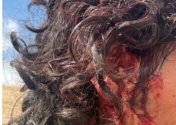 פורעים ערבים ביצעו לינץ' ברועה יהודי בבקעת הירדן