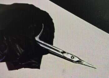 דקר במספרי ציפורניים: יוגש כתב אישום נגד התוקף