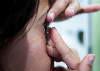 קנתה עדשות מגע מהאינטרנט – ואושפזה עם כוויות חמורות בעיניה