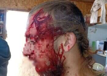 רועה צאן יהודי הותקף בגוש עציון. ללא קרדיט רועה צאן יהודי הותקף באלות בגוש עציון: התוקפים נמלטו