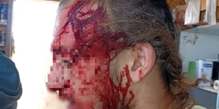 רועה צאן יהודי הותקף בגוש עציון. ללא קרדיט רועה צאן יהודי הותקף באלות בגוש עציון: התוקפים נמלטו